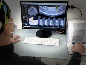 Implantologia Computer Guidata
